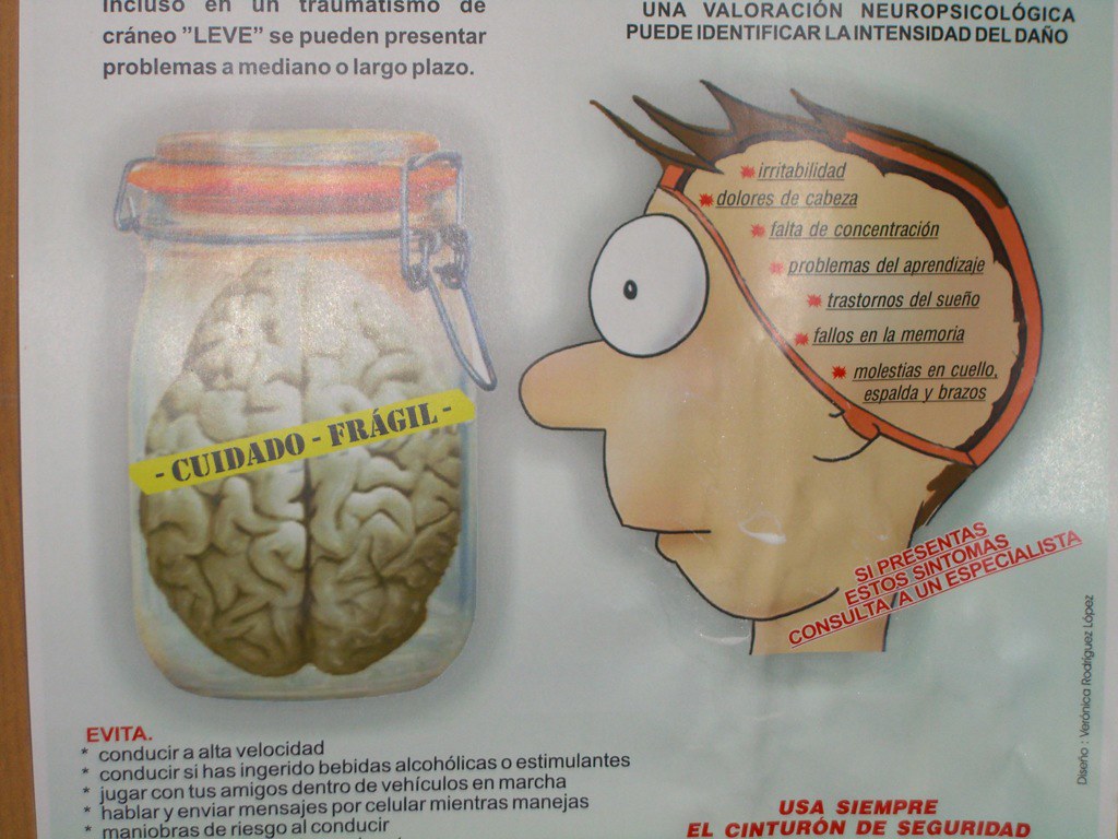 protect your brain