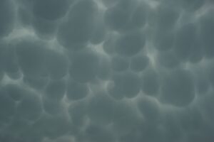 severe turbulence injuries